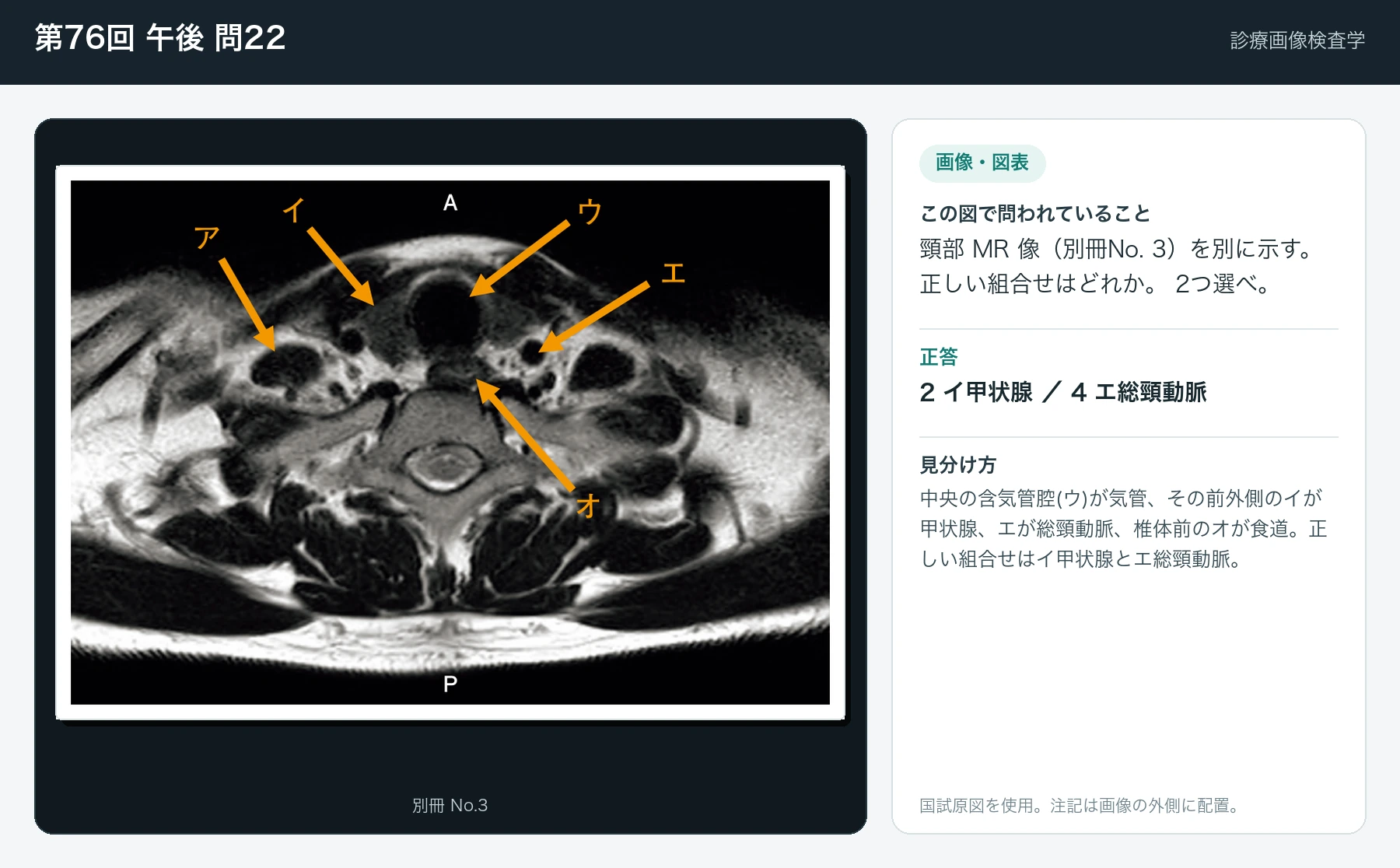 第76回 午後 問22の画像と見分け方