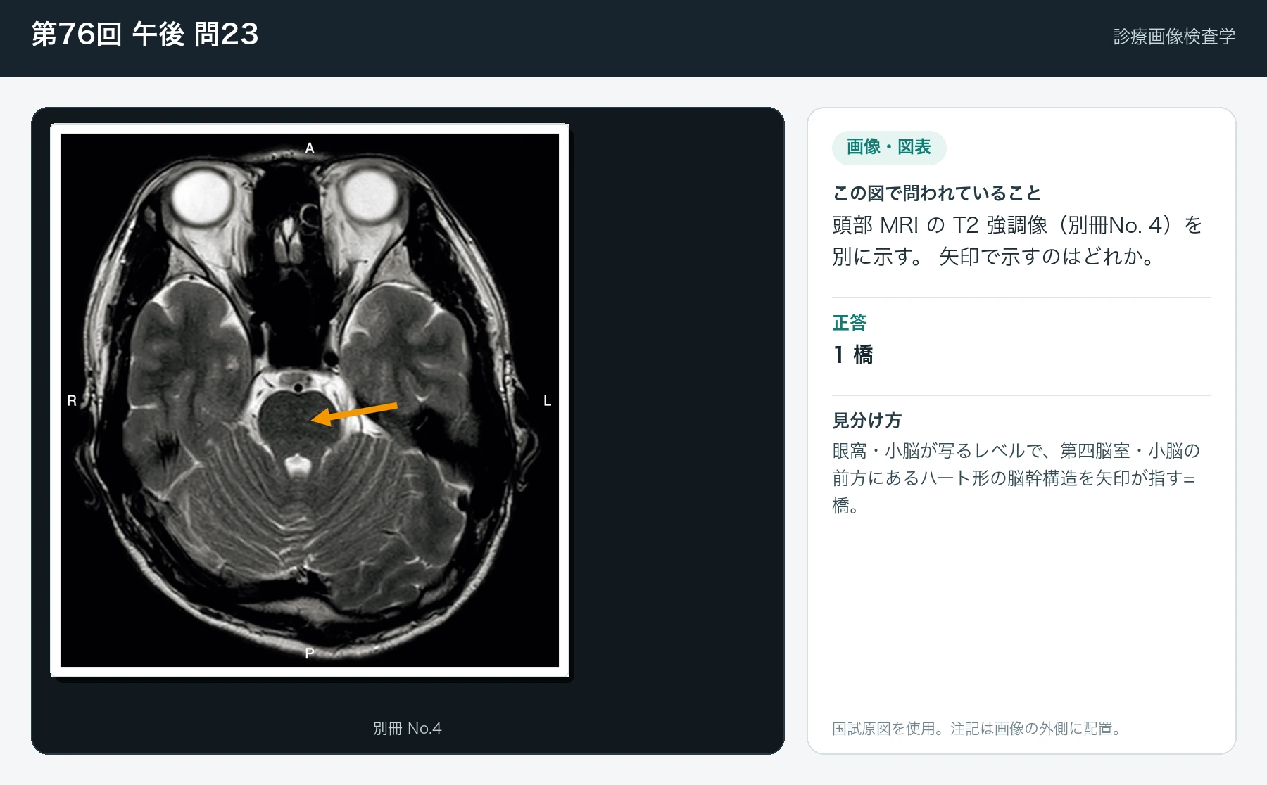 第76回 午後 問23の画像と見分け方