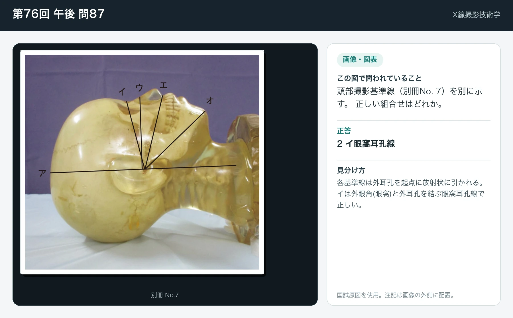 第76回 午後 問87の画像と見分け方