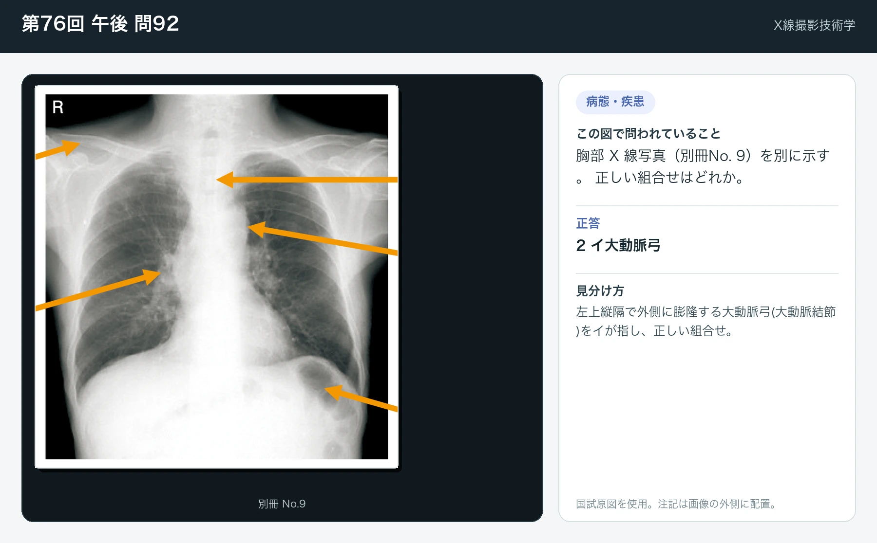 第76回 午後 問92の画像と見分け方