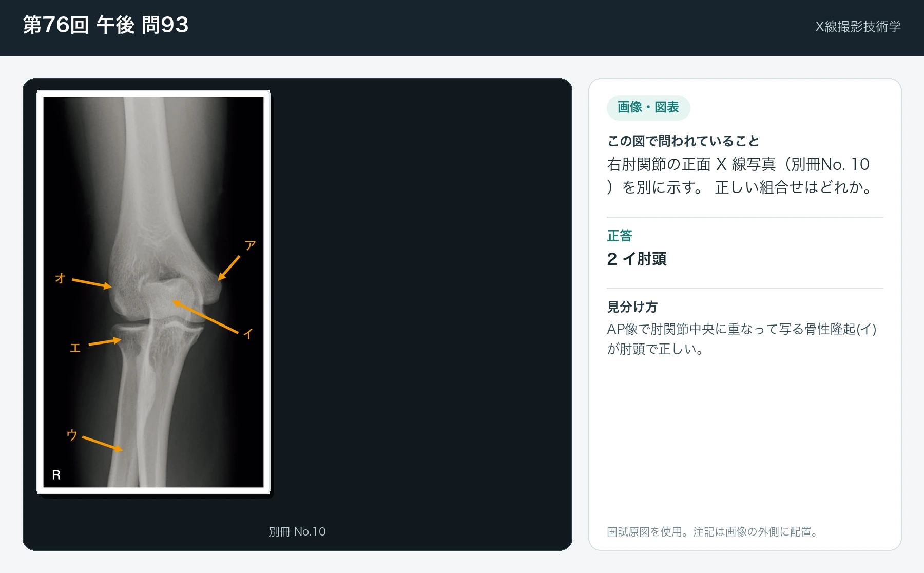 第76回 午後 問93の画像と見分け方