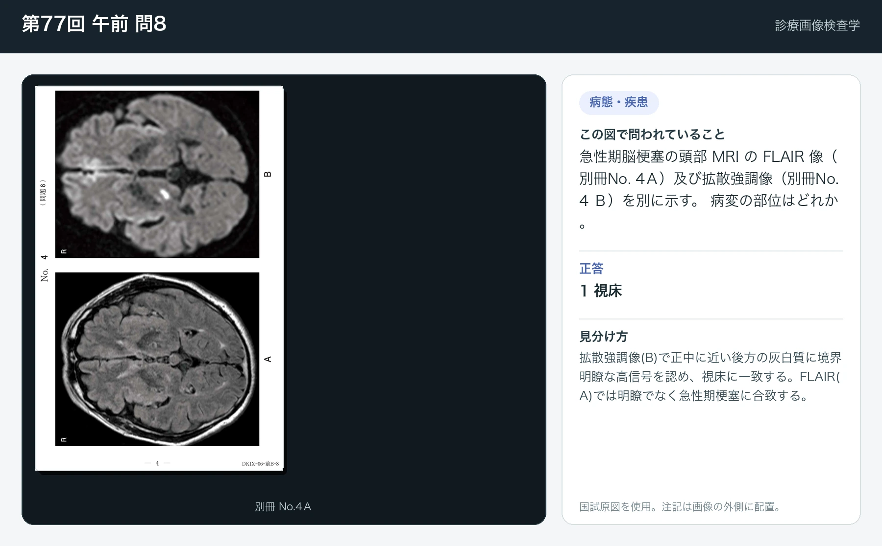 第77回 午前 問8の画像と見分け方
