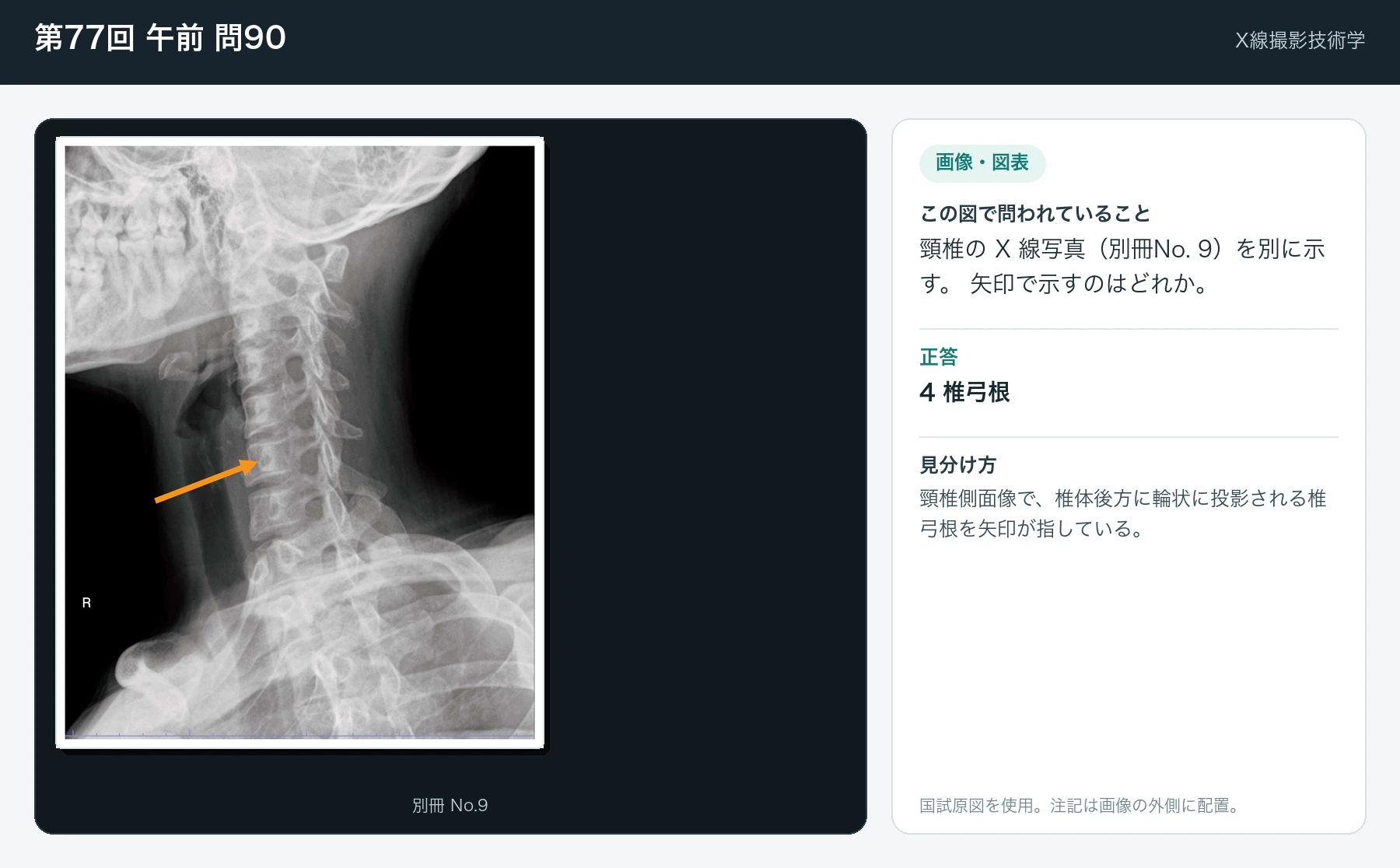 第77回 午前 問90の画像と見分け方