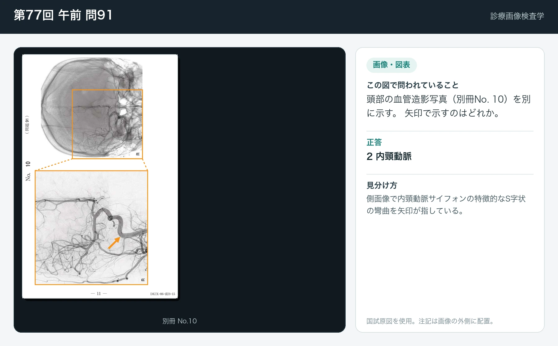 第77回 午前91の画像と見分け方