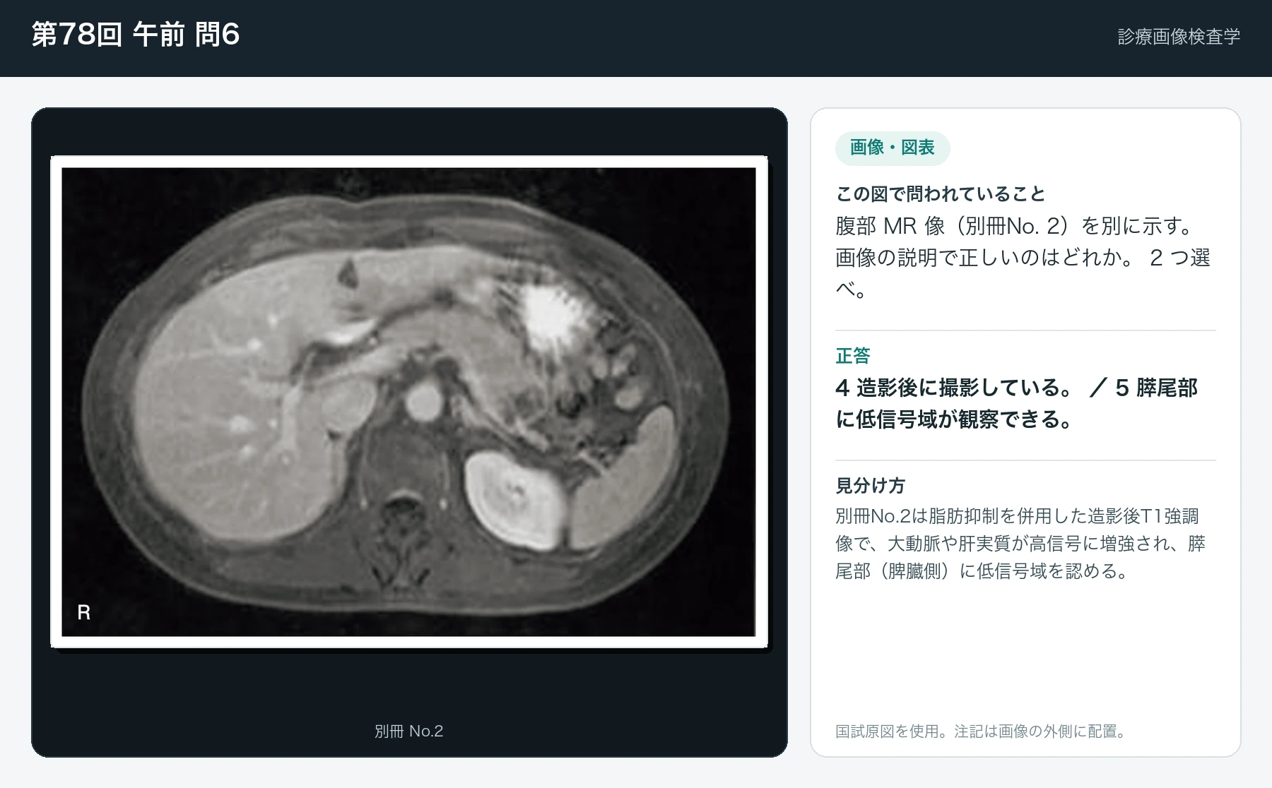 第78回 午前6の画像と見分け方