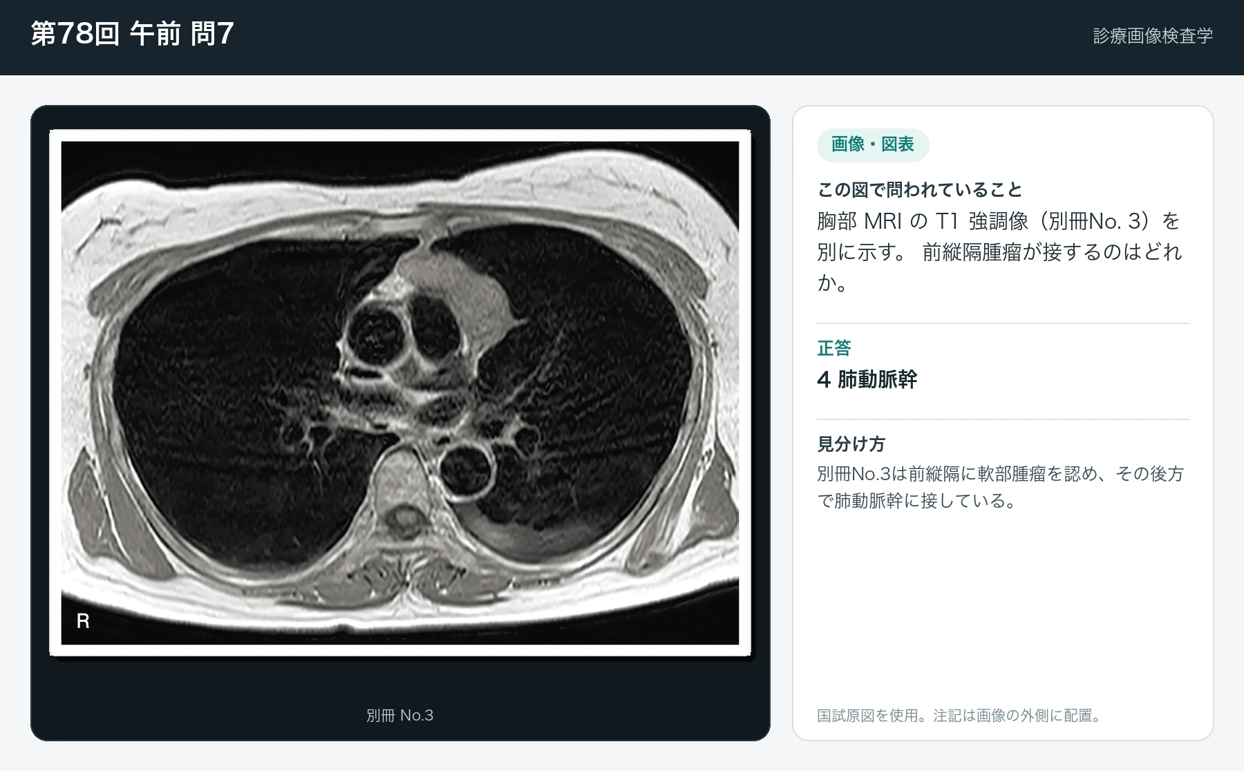 第78回 午前7の画像と見分け方