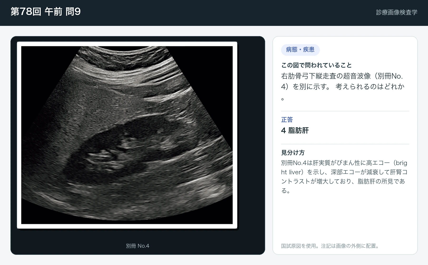 第78回 午前9の画像と見分け方