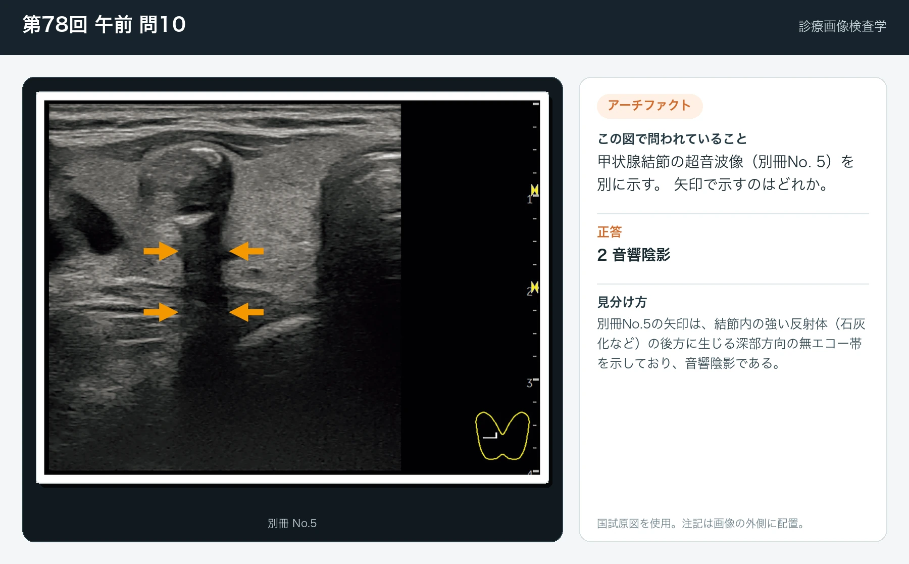 第78回 午前10の画像と見分け方