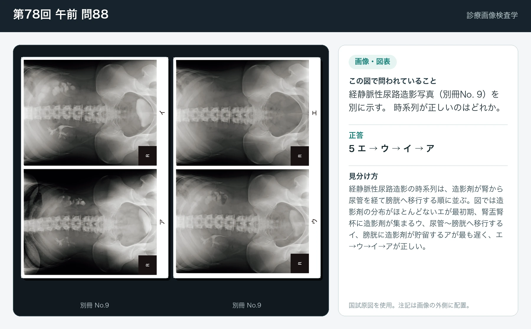 第78回 午前88の画像と見分け方