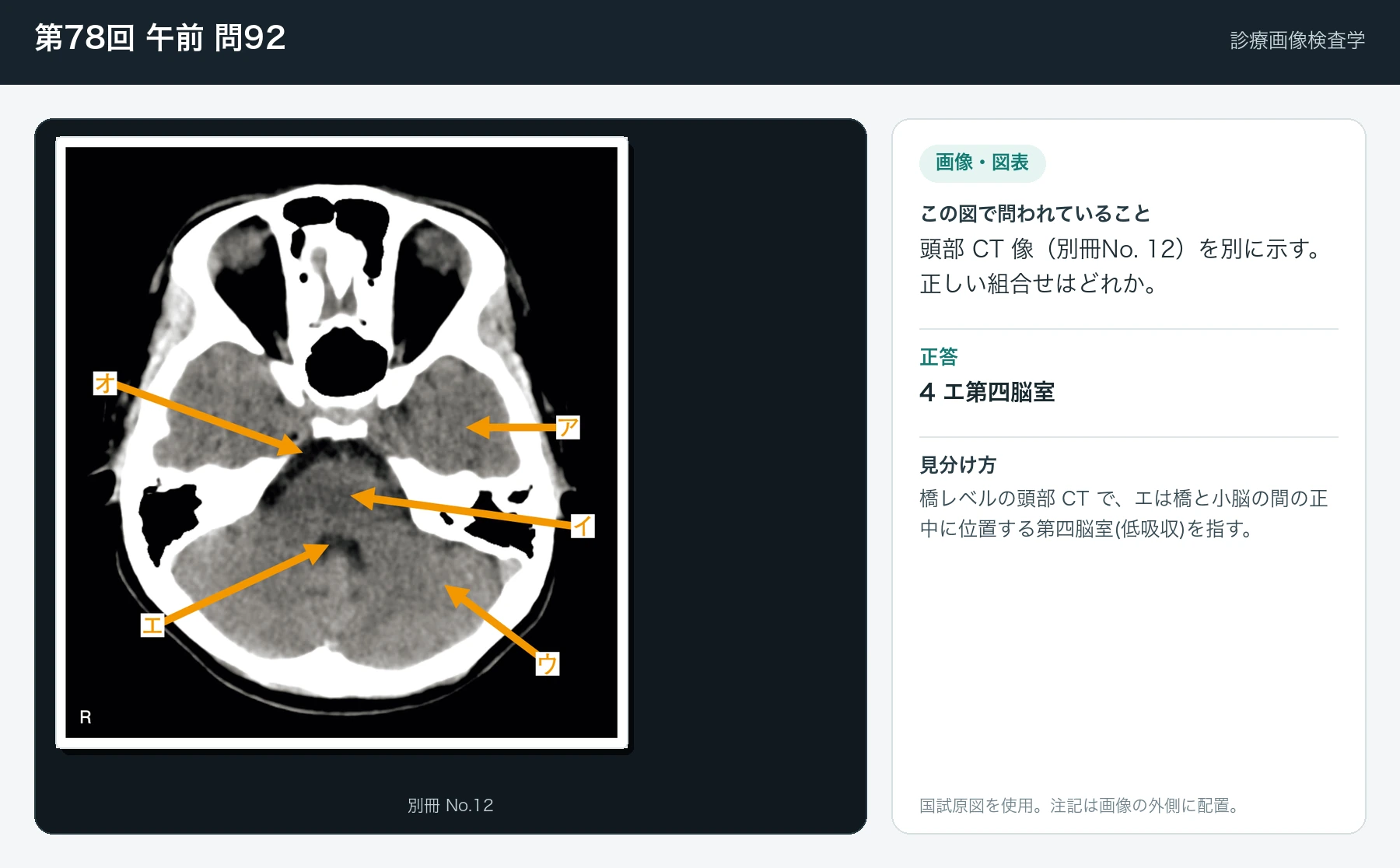 第78回 午前92の画像と見分け方