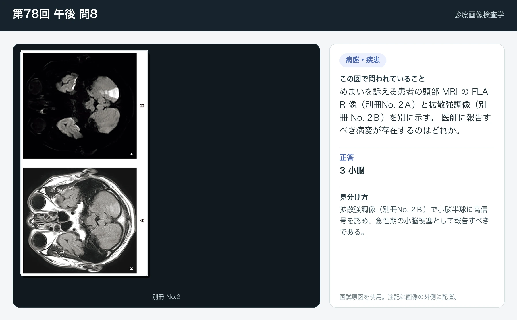 第78回 午後8の画像と見分け方