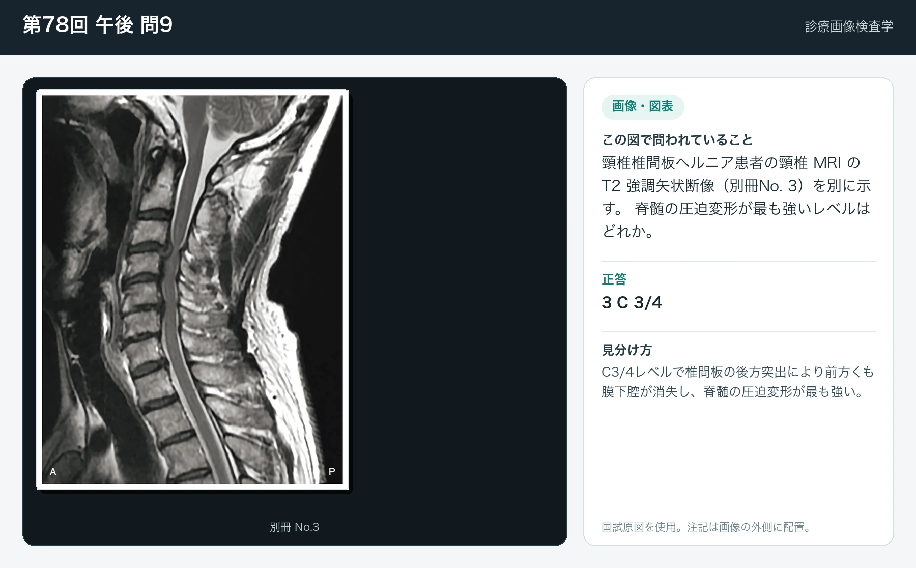 第78回 午後9の画像と見分け方