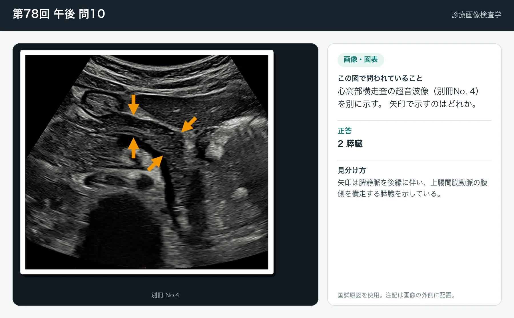 第78回 午後10の画像と見分け方