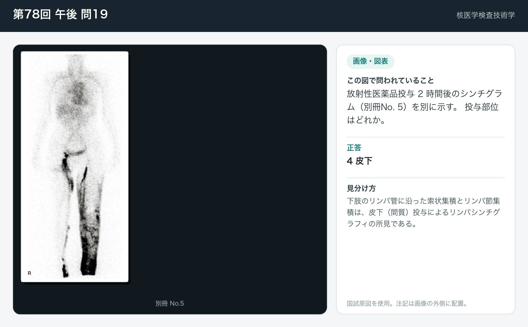 第78回 午後19の画像と見分け方