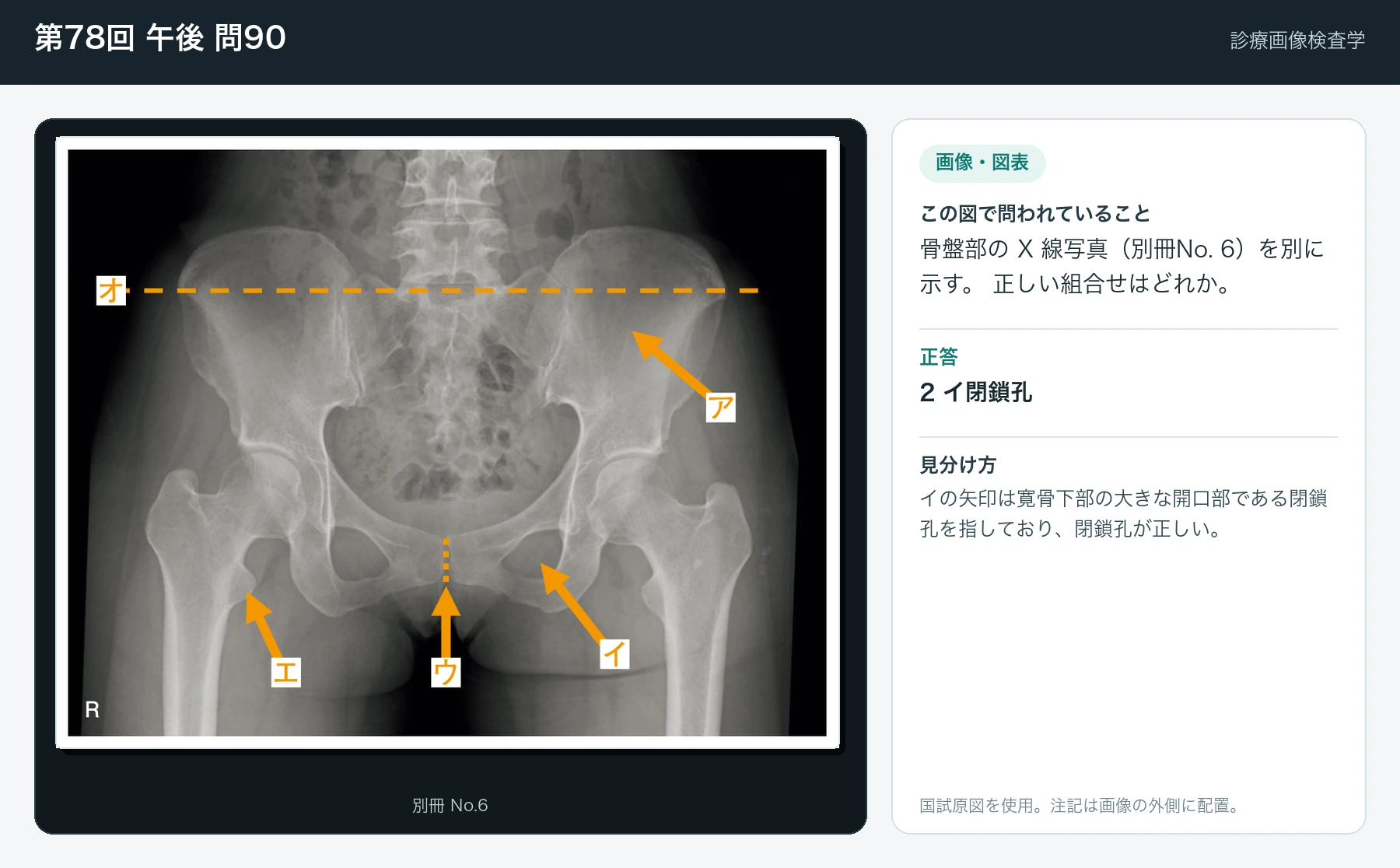 第78回 午後90の画像と見分け方