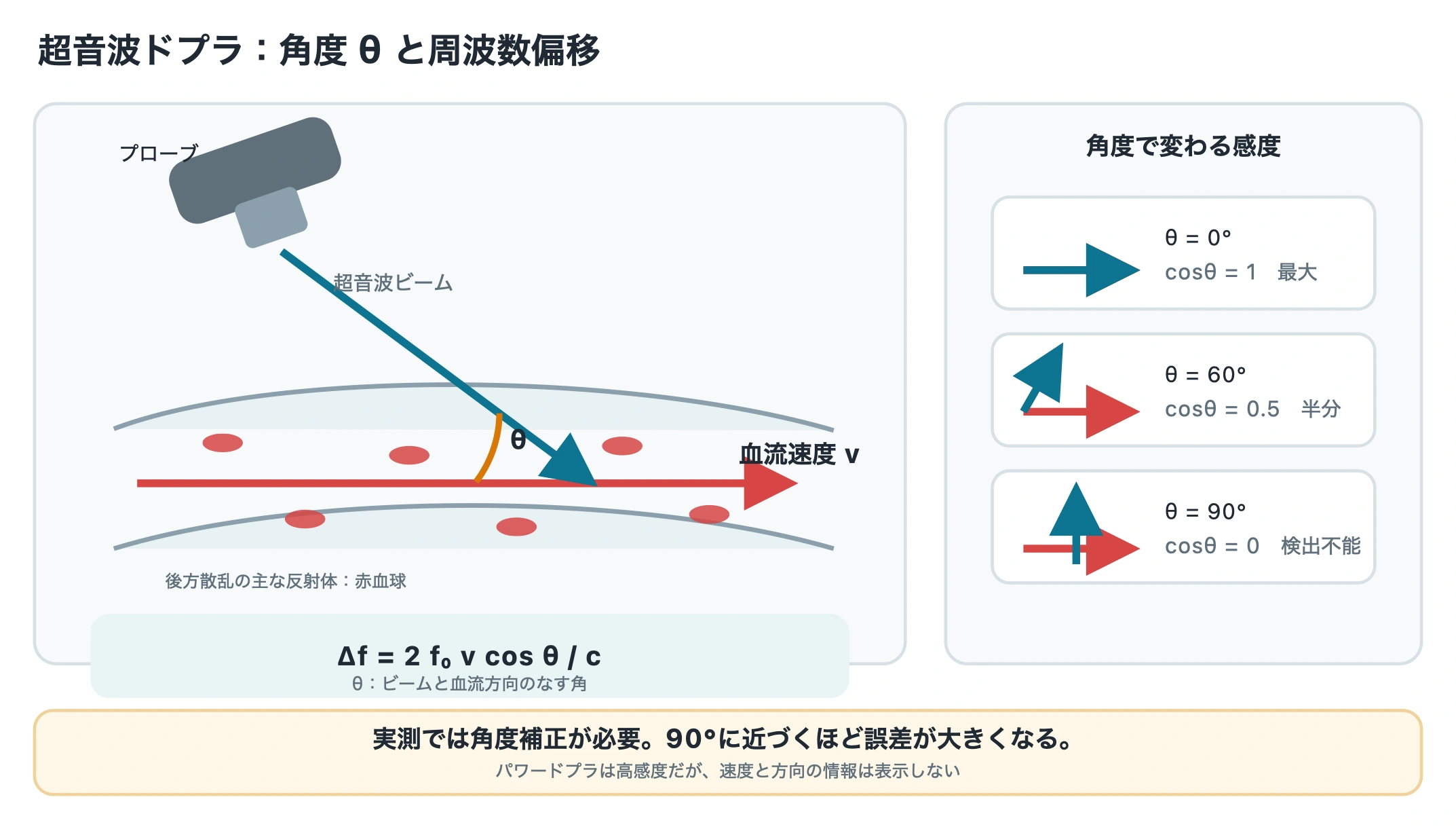 図: ドプラ偏移はビームと血流の角度の cosθ に比例し、90°では理論上0になる。